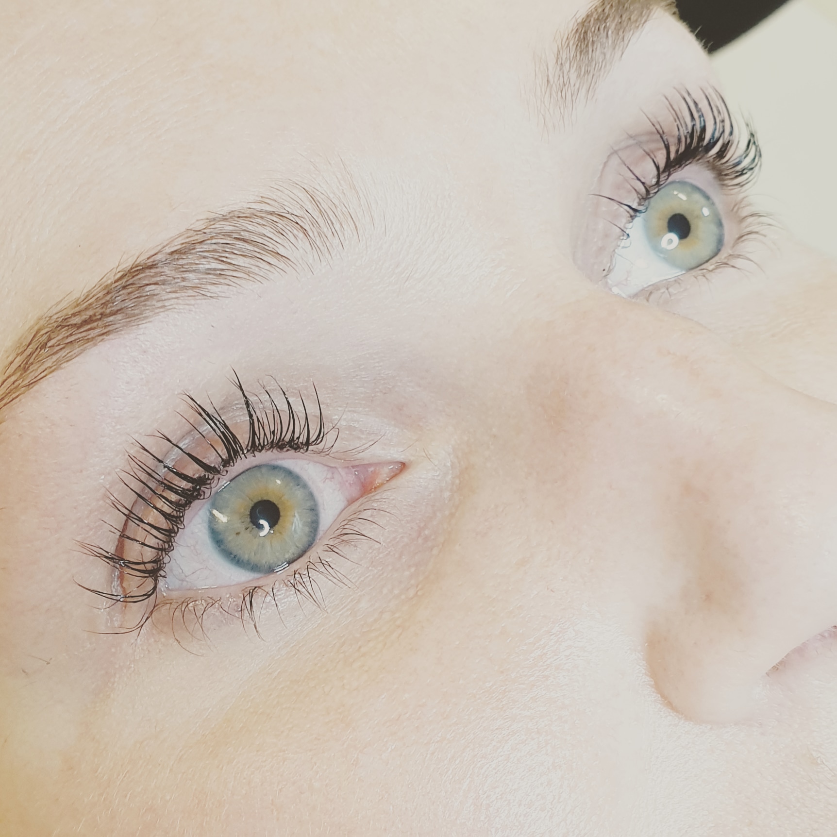 resultaat lashlift