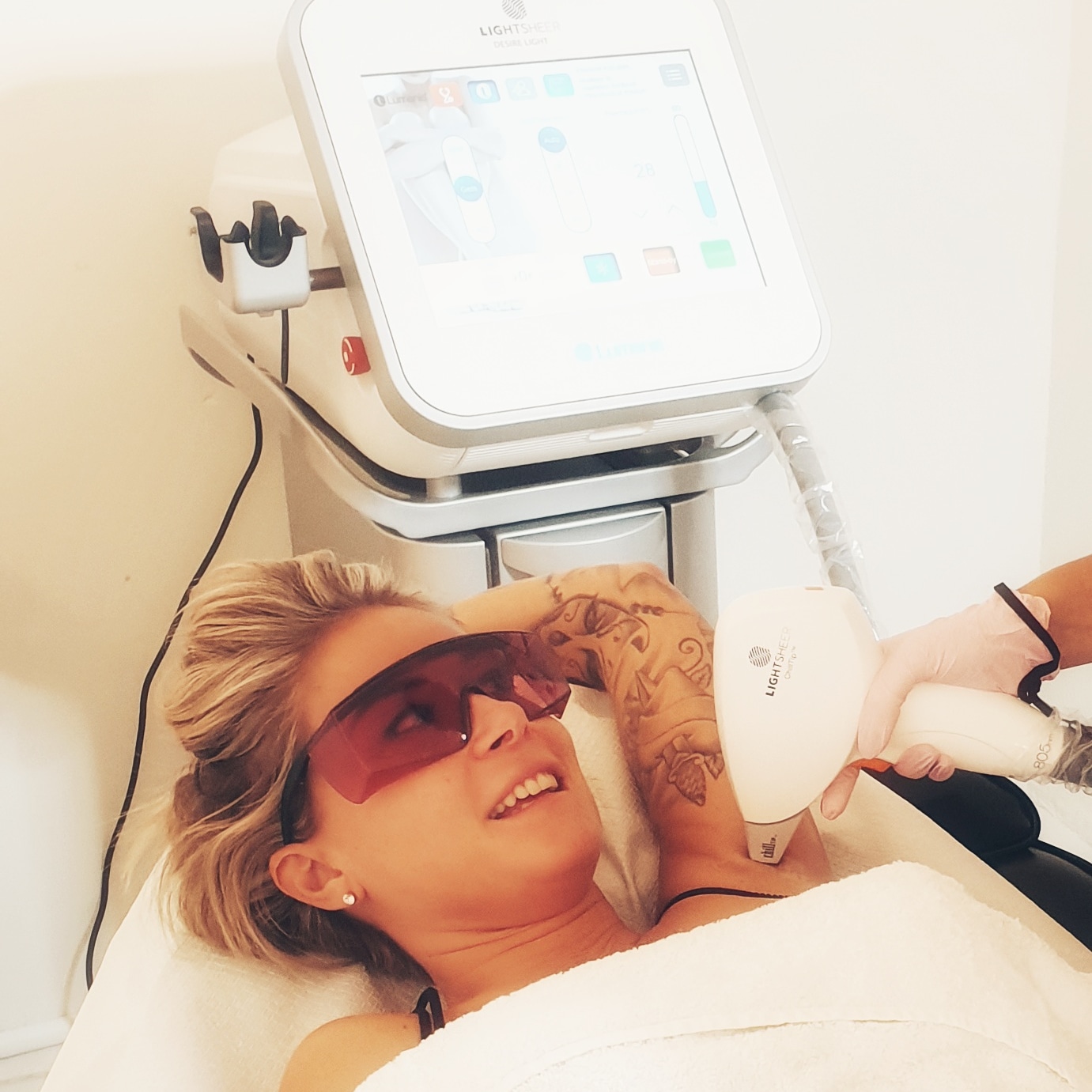 Foto van laserontharing oksel