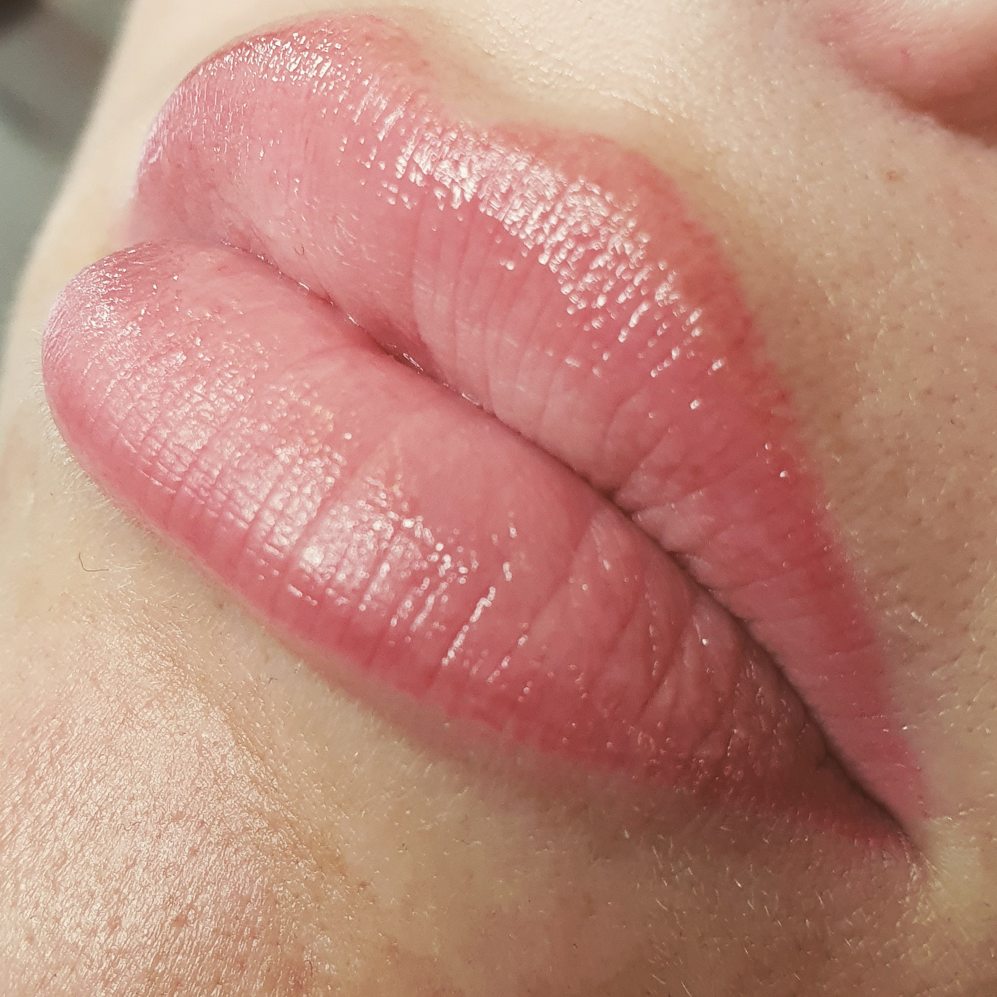 Voorbeeld lippigmentatie